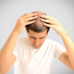 Hair Restoration Wall NJ