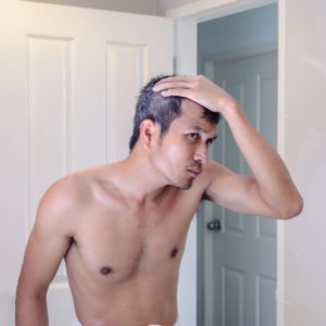 Hair Restoration Manasquan NJ