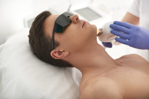 Laser hair removal procedure of young man