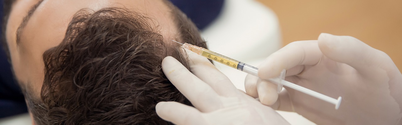 PRP Hair Restoration Toms River NJ