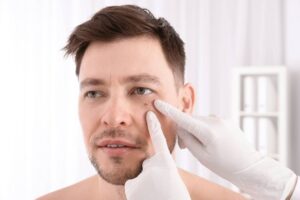 Skin Cancer Treatment Manasquan NJ